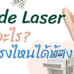 Diode laser คืออะไร? ทำบริเวณไหนได้บ้าง?