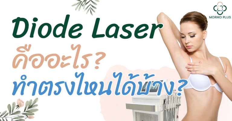 Diode laser คืออะไร? ทำบริเวณไหนได้บ้าง?