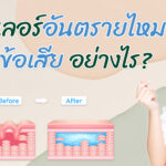 ฉีดฟิลเลอร์อันตรายไหม? มีข้อดี-ข้อเสียอย่างไร?