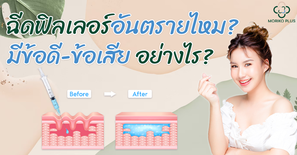 ฉีดฟิลเลอร์อันตรายไหม? มีข้อดี-ข้อเสียอย่างไร?