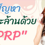 การฉีด “PRP” ตัวช่วยแก้ปัญหาศีรษะล้านจากการผมร่วง