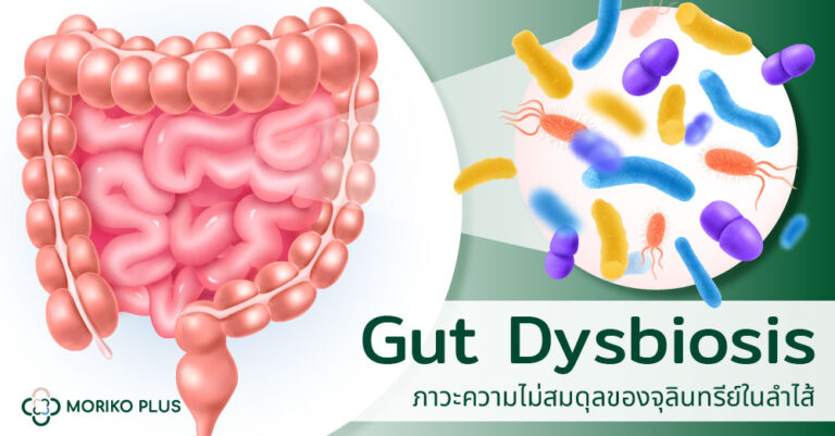 Gut Dysbiosis ภาวะความไม่สมดุลของจุลินทรีย์ในลำไส้