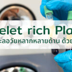 เทคนิคชะลอวัยหลากหลายด้าน ด้วย PRP ( Platelet rich Plasma )