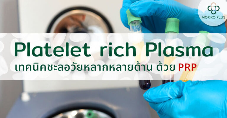 เทคนิคชะลอวัยหลากหลายด้าน ด้วย PRP ( Platelet rich Plasma )